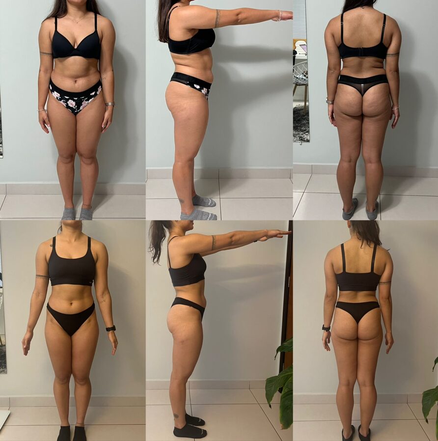 Resultado de paciente — antes e depois