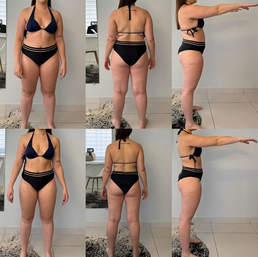 Resultado de paciente — antes e depois